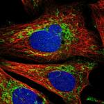 CCM2 Antibody in Immunocytochemistry (ICC/IF)