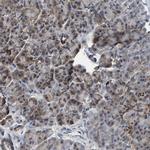 CCM2 Antibody in Immunohistochemistry (IHC)