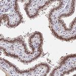 BCL9 Antibody in Immunohistochemistry (Paraffin) (IHC (P))