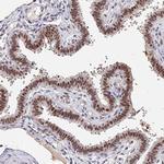 BCL9 Antibody in Immunohistochemistry (IHC)