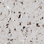 VPS41 Antibody in Immunohistochemistry (Paraffin) (IHC (P))