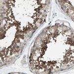 VPS41 Antibody in Immunohistochemistry (Paraffin) (IHC (P))