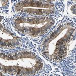 PSPH Antibody in Immunohistochemistry (Paraffin) (IHC (P))