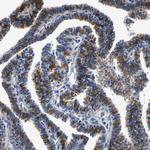 PSPH Antibody in Immunohistochemistry (Paraffin) (IHC (P))