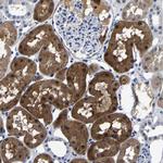 PSPH Antibody in Immunohistochemistry (Paraffin) (IHC (P))