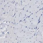 PSPH Antibody in Immunohistochemistry (Paraffin) (IHC (P))