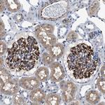 PKD1L1 Antibody in Immunohistochemistry (Paraffin) (IHC (P))