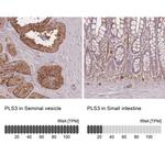 PLS3 Antibody in Immunohistochemistry (IHC)