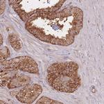 PLS3 Antibody in Immunohistochemistry (IHC)