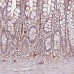 PLS3 Antibody in Immunohistochemistry (IHC)