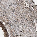 DNAJC2 Antibody in Immunohistochemistry (IHC)