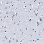 LRRC8E Antibody in Immunohistochemistry (Paraffin) (IHC (P))