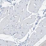 SHMT2 Antibody in Immunohistochemistry (Paraffin) (IHC (P))