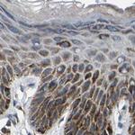 SHMT2 Antibody in Immunohistochemistry (IHC)