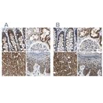 SHMT2 Antibody in Immunohistochemistry (IHC)