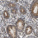 SHMT2 Antibody in Immunohistochemistry (IHC)