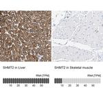 SHMT2 Antibody