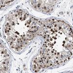 MIS18A Antibody in Immunohistochemistry (Paraffin) (IHC (P))