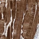 ZCCHC6 Antibody in Immunohistochemistry (Paraffin) (IHC (P))