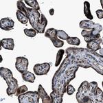 TNRC18 Antibody in Immunohistochemistry (IHC)