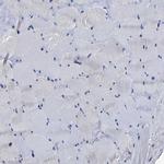 AASS Antibody in Immunohistochemistry (Paraffin) (IHC (P))