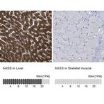 AASS Antibody in Immunohistochemistry (IHC)