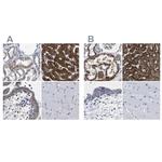 AASS Antibody in Immunohistochemistry (IHC)