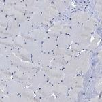 AASS Antibody in Immunohistochemistry (IHC)