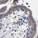 AASS Antibody in Immunohistochemistry (IHC)