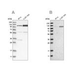 AASS Antibody in Western Blot (WB)