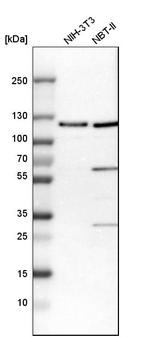 AASS Antibody in Western Blot (WB)