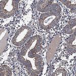 NEK1 Antibody in Immunohistochemistry (Paraffin) (IHC (P))