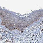 NEK1 Antibody in Immunohistochemistry (Paraffin) (IHC (P))