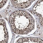 NEK1 Antibody in Immunohistochemistry (Paraffin) (IHC (P))