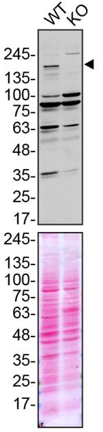 NEK1 Antibody in Western Blot (WB)