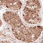 LMO7 Antibody in Immunohistochemistry (IHC)