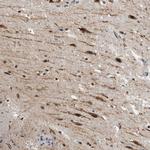 ZMYND8 Antibody in Immunohistochemistry (IHC)