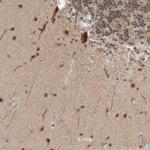 ZMYND8 Antibody in Immunohistochemistry (IHC)