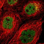 ZMYND8 Antibody in Immunocytochemistry (ICC/IF)