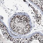 ZNF233 Antibody in Immunohistochemistry (Paraffin) (IHC (P))