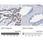 ZFAT Antibody in Immunohistochemistry (IHC)