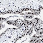 ZFAT Antibody in Immunohistochemistry (IHC)