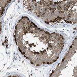 PLAA Antibody in Immunohistochemistry (Paraffin) (IHC (P))