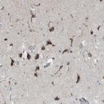 PLAA Antibody in Immunohistochemistry (Paraffin) (IHC (P))