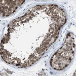 PLAA Antibody in Immunohistochemistry (Paraffin) (IHC (P))