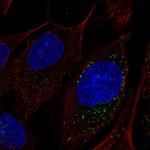 LAMTOR4 Antibody in Immunocytochemistry (ICC/IF)