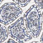 LAMTOR4 Antibody in Immunohistochemistry (Paraffin) (IHC (P))