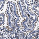 LAMTOR4 Antibody in Immunohistochemistry (IHC)