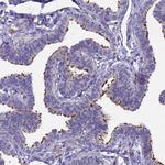 POP7 Antibody in Immunohistochemistry (IHC)