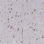 POP7 Antibody in Immunohistochemistry (IHC)